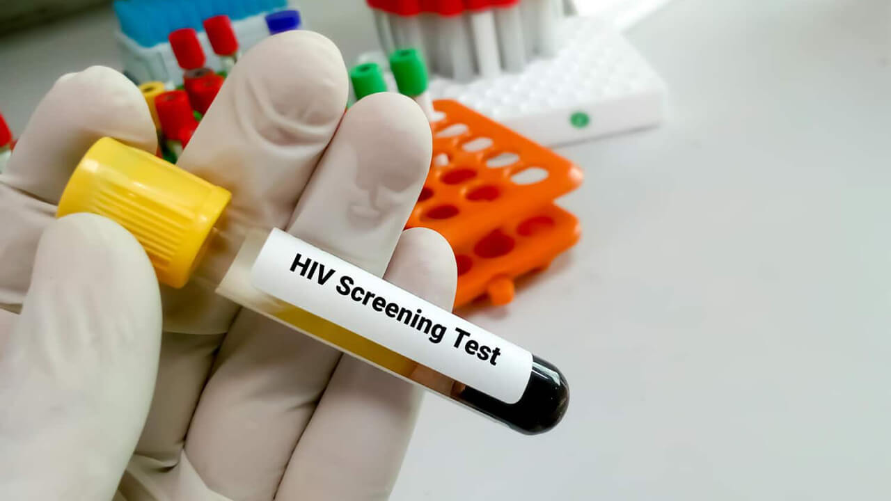 Eine behandschuhte Hand hält ein mit gelbem Verschluss versehenes Röhrchen, beschriftet mit „HIV Screening Test“. Im Hintergrund sind weitere Probenröhrchen und Laborutensilien sichtbar.
